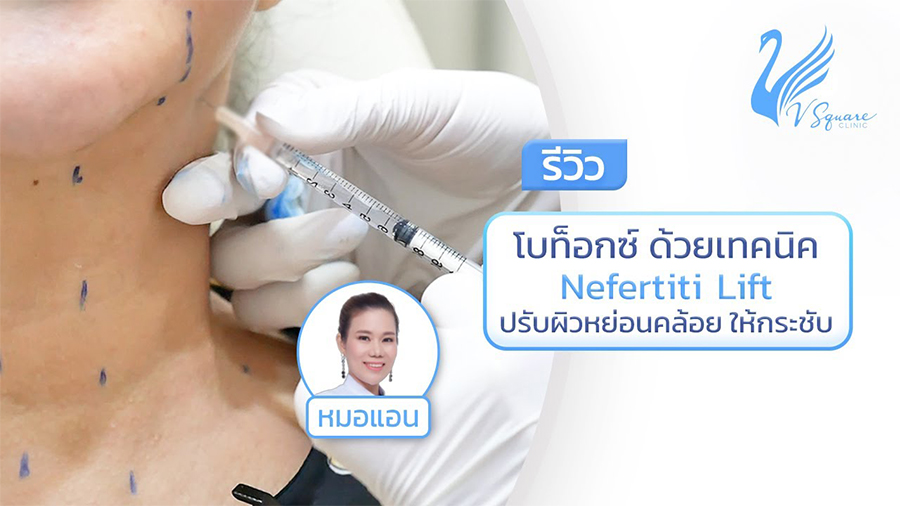 รีวิว ฉีดโบท็อก Nefertiti lift แก้ปัญหาผิวไม่กระชับ คอหย่อนคล้อย