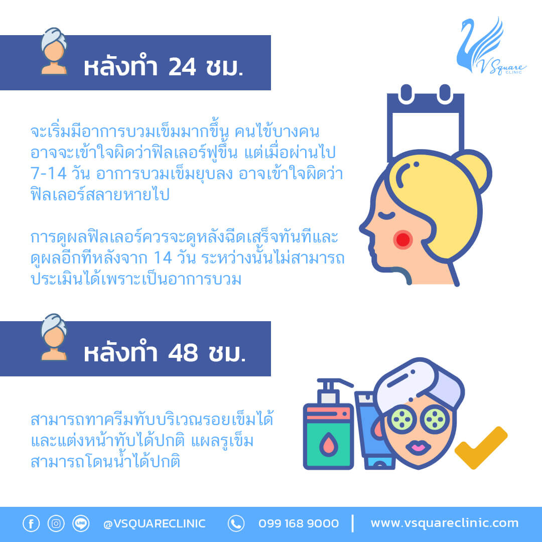 ข้อห้าม ข้อปฎิบัติ หลังฉีดฟิลเลอร์ อะไรบ้างที่ควรรู้ เพื่อผลลัพธ์ที่ดีและอยู่ได้นาน