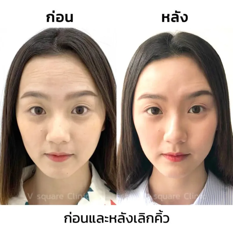 10 วิธีกู้หน้าโทรมแบบเร่งด่วน ฟื้นฟูผิวเสีย ให้ดูสุขภาพดี อย่างปลอดภัย