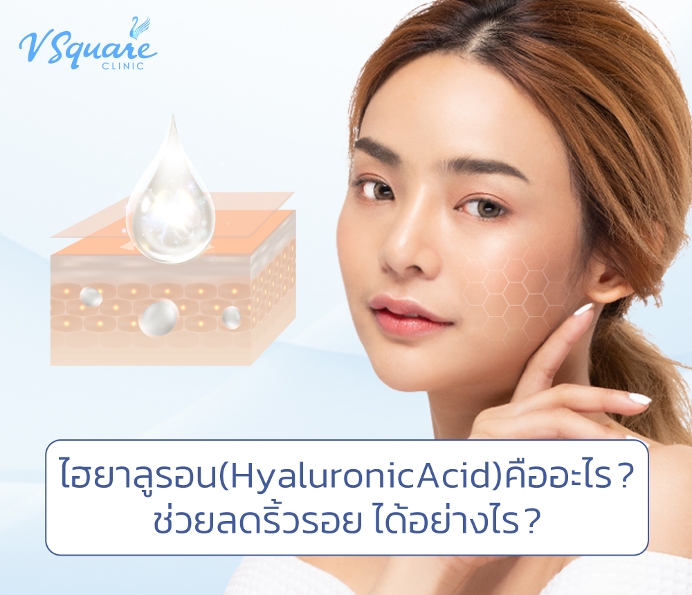 กรดไฮยาลูรอนิค Hyaluronic Acid